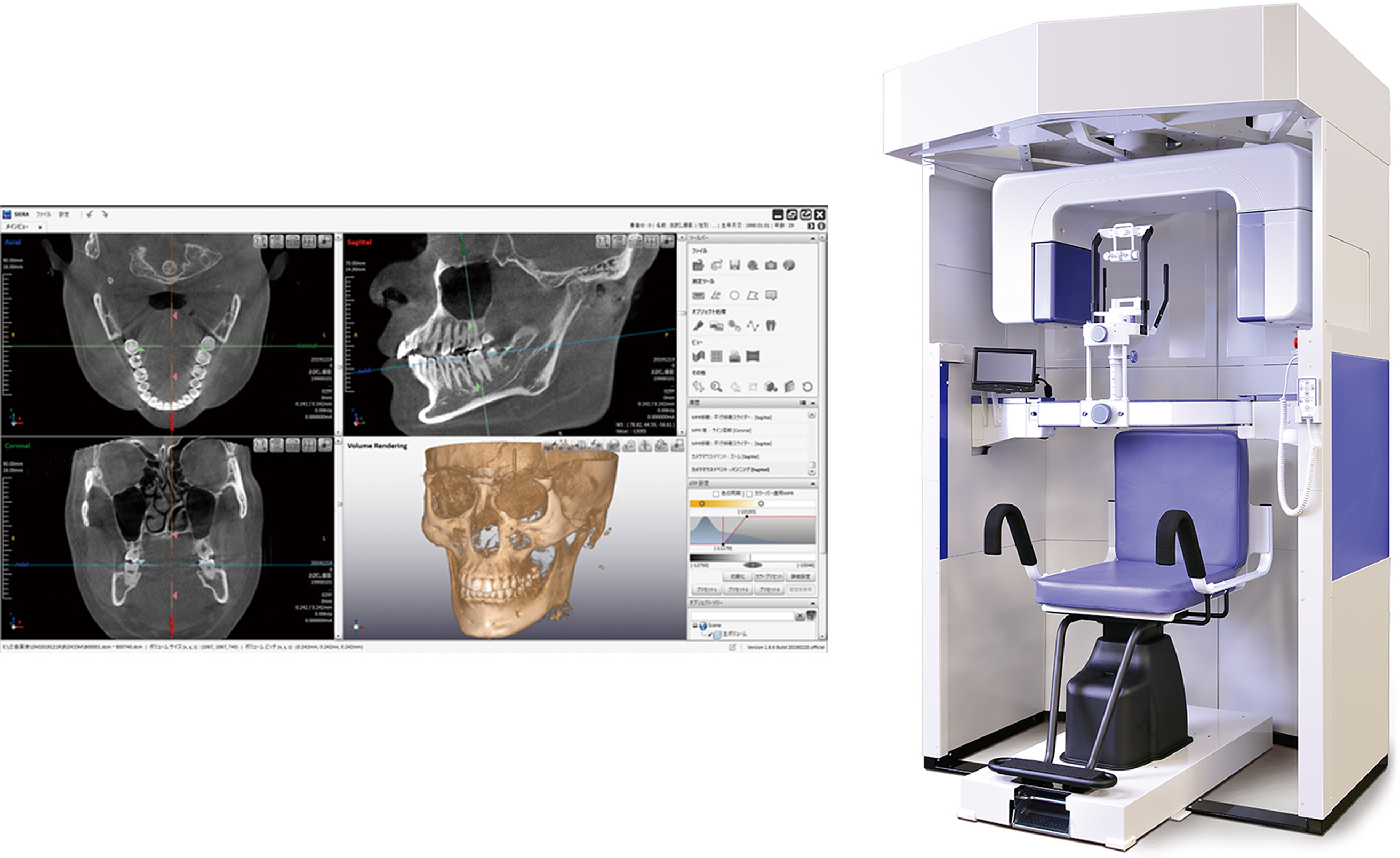 歯科用３ＤーＣＴ