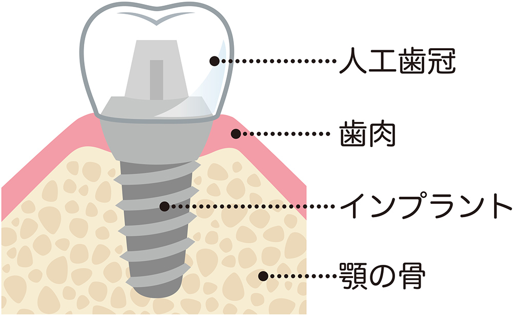 治療の流れ